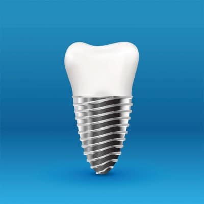 A strong dental implant