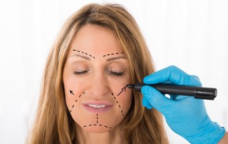 Surgeon Drawing Correction Lines On Woman Face